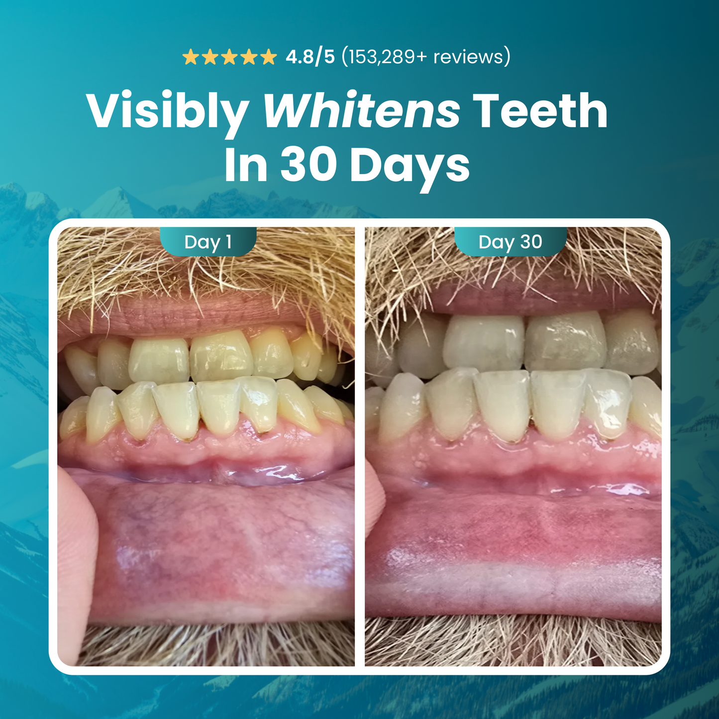 Larineco™️ - Remineralizing Gum